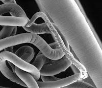 Vinculan la infección parasitaria con el microbioma intestinal