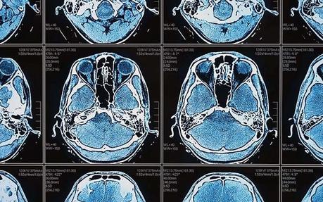 La inteligencia artificial en la empresa se tiene que apoyar en pilares éticos