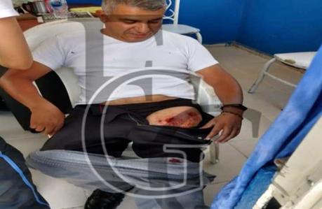 Motociclistas lesionan a Policía Municipal en Las Julias