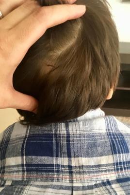 golpe en la cabeza experiencia