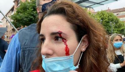 Le herida “inventada” de una diputada de Vox. Le herida “inventada” de una diputada de Vox.