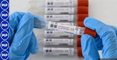 ALEMANIA DONA 100 MIL PRUEBAS DE CORONAVIRUS A PERÚ…