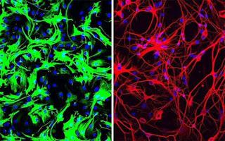 ¿Una vía para eliminar la enfermedad de Parkinson? ¿Una vía para eliminar la enfermedad de Parkinson?