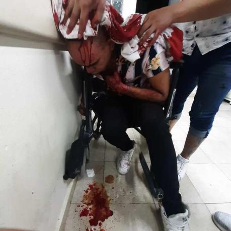 Acusan a seguridad del antro «Glitter» de golpear a joven Acusan a seguridad del antro «Glitter» de golpear a joven