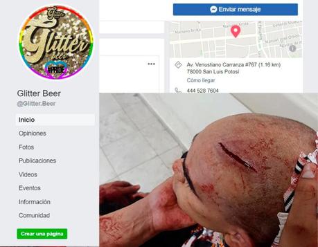 Acusan a seguridad del antro «Glitter» de golpear a joven