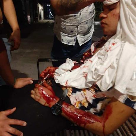 Acusan a seguridad del antro «Glitter» de golpear a joven Acusan a seguridad del antro «Glitter» de golpear a joven