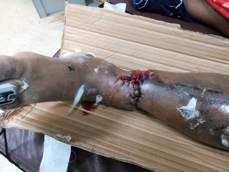 Hermano de comunicadora de Neiba requiere de urgencia sangre Tipo B Positivo. Hermano de comunicadora de Neiba requiere de urgencia sangre Tipo B Positivo.
