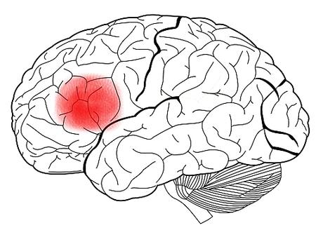 Las áreas del cerebro responsables del lenguaje / The areas of the brain responsible for language Las áreas del cerebro responsables del lenguaje / The areas of the brain responsible for language