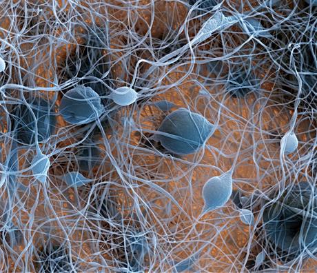 FEI Company – Imágenes realizadas con un microscopio electrónico de barrido