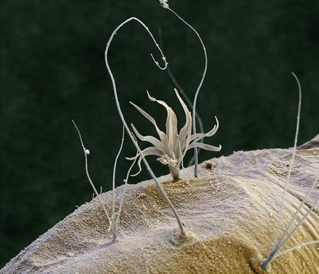 FEI Company – Imágenes realizadas con un microscopio electrónico de barrido