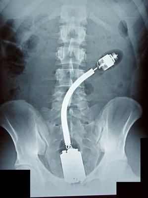 X-Ray: ..Adentro!