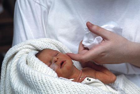 Médicos evitarían el soporte vital en casos de bebés muy enfermos