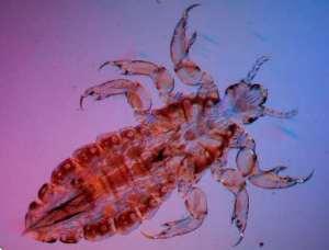 piojo dos Otro 'alien', a sumar a la lista, que le encanta vivir a costa nuestra.