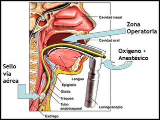 Respuesta a accidente anestésico en odontología pediátrica