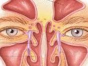 lavado nasal: soluciona problemas respiratorios