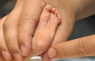 Tamiz neonatal identifica enfermedades y permite tratamiento oportuno para el recién nacido