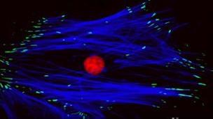Científicos del Reino Unido crean esperanza para el desarrollo de células madre en el cerebro