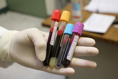 PREPARA EDOMÉX INVESTIGACIÓN DE PLASMA PARA TRATAR COVID-19; ESMERALDA Y YERARD LOS PRIMEROS DONADORES