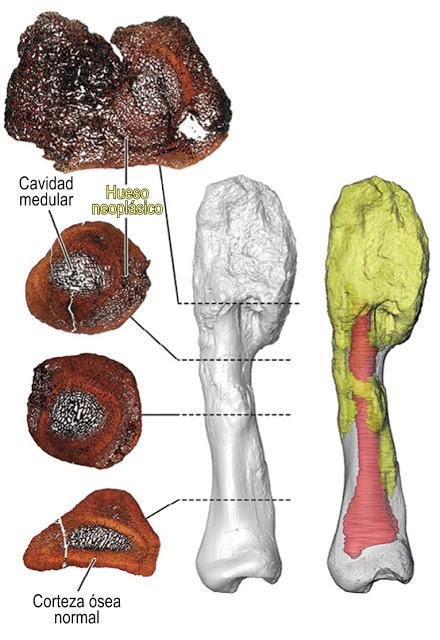 Descubren cáncer en un dinosaurio