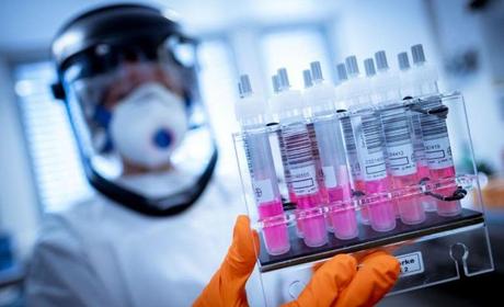 Coronavirus: Brasil espera producir masivamente la vacuna de Oxford en diciembre