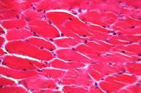 Identifican como las células musculares descomponen las grasas