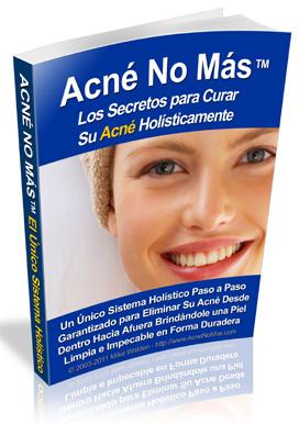 Curar el acné: causas y 7 remedios naturales Curar el acné: causas y 7 remedios naturales