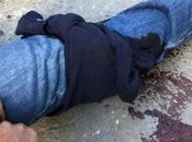 Balean Policía Estatal durante asalto