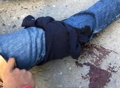 Balean Policía Estatal durante asalto