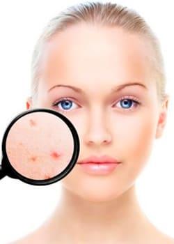 ¿Cómo afecta el verano sobre mi piel?