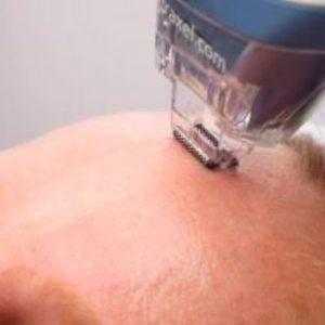 Cómo hidratar la piel de rostro y cuerpo tras el verano