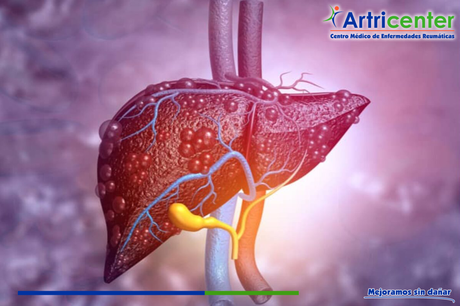 ¿Puede afectarse el hígado en la artritis reumatoide?