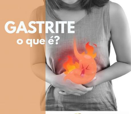 Omeprazol: Qué es, Cómo tomarlo, Efectos secundarios