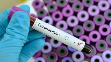Posibles tratamientos contra el nuevo Coronavirus Covid-19