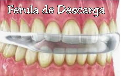 Bruxismo:  Como Afecta el estrès cotidiano a mis Dientes