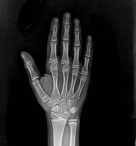 Efectos de la radiación nuclear en nuestra salud Efectos de la radiación nuclear en nuestra salud