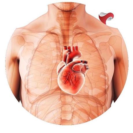 ¡Alerta! Conoce los primeros síntomas antes de un infarto al Corazón tipos de infarto