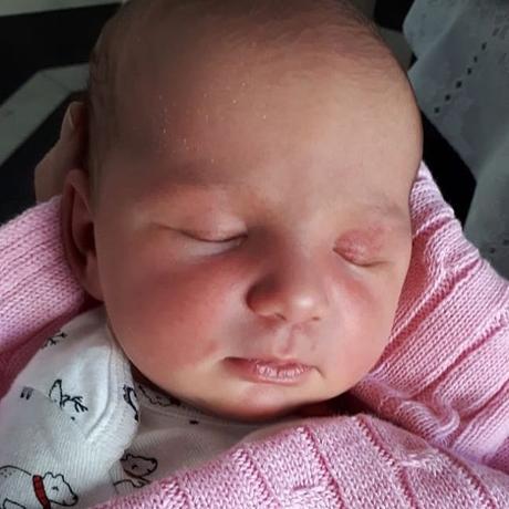 Fontanela del Bebé: síntomas, características, cuidados y peligros que es la fontanela bebé