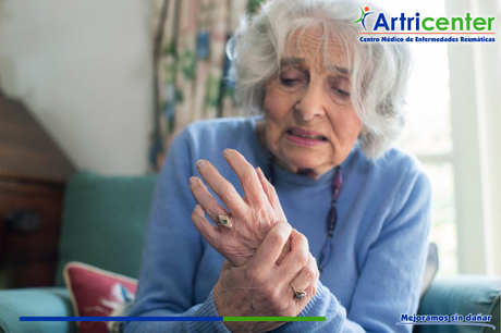 ¿Cómo saber si apareció una nueva crisis de artritis reumatoide?