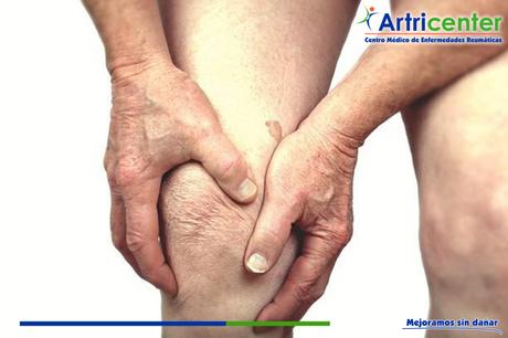 Consecuencias de la artrosis.