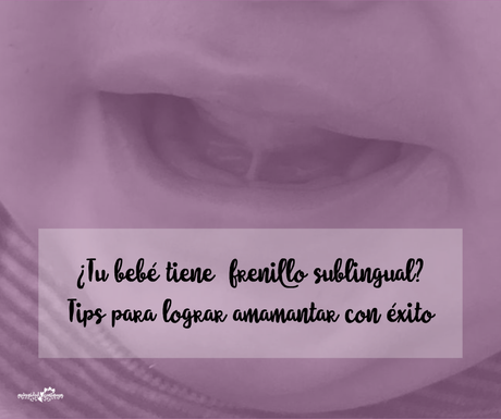 ¿Tu bebé tiene frenillo sublingual? Tips para lograr amamantar con éxito ¿Tu bebé tiene frenillo sublingual? Tips para lograr amamantar con éxito