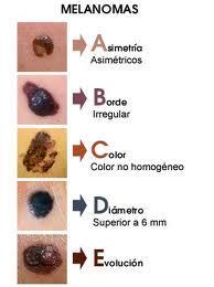 Cáncer de piel