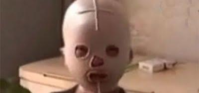 Condenado a llevar máscara para sobrevivir