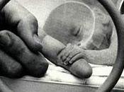 Relacionan prematurez riesgos psiquiatricos adolescencia