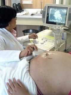 Diagnóstico y tratamiento temprano, la mejor estrategia contra el lupus