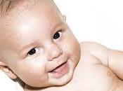 ictericia afecta recién nacidos