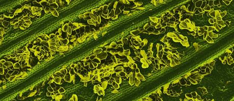 Caren Alpert – Lo que comemos, bajo el microscopio