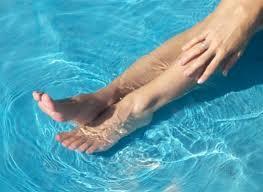 varicesverano Como evitar nuevas varices en verano