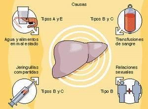 prevencion, hepatitis, higiene, evitar