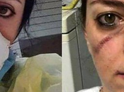 Piel seca culpa mascarilla quirurgica