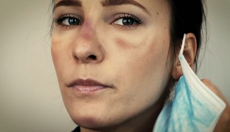 Piel seca por mascarilla quirurgica Piel seca por culpa de mascarilla quirurgica